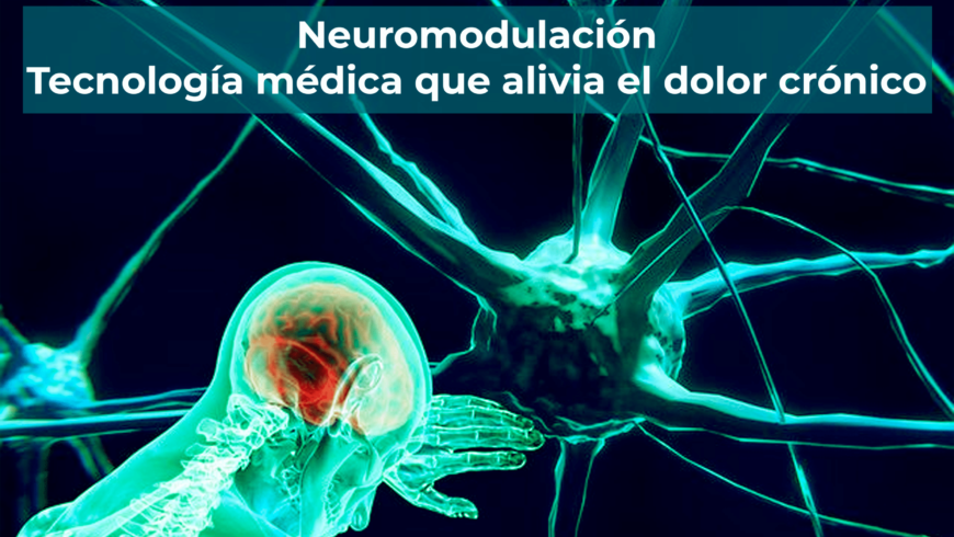Neuromodulación: la tecnología médica que alivia el dolor crónico